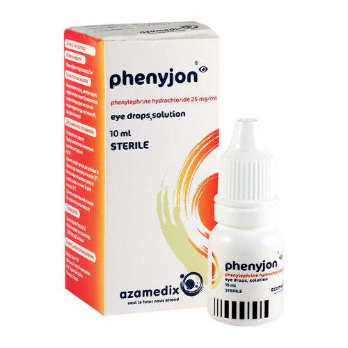 ფენიჟონი